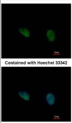 Immunocytochemistry/ Immunofluorescence: PHKG2 Antibody [NBP2-19802]