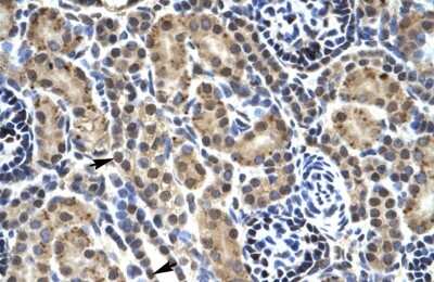 Immunohistochemistry-Paraffin: PHKG2 Antibody [NBP1-54866]