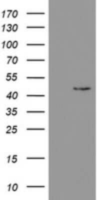 Western Blot: PHKG2 Antibody (OTI1F9)Azide and BSA Free [NBP2-73373]