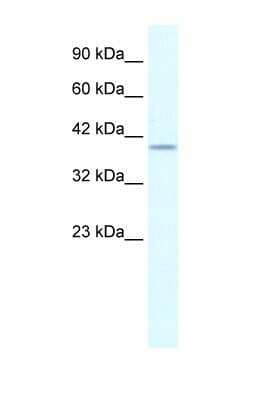 Western Blot: PHKG2 Antibody [NBP1-54866]