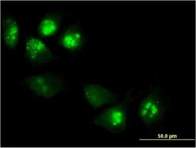 Immunocytochemistry/ Immunofluorescence: PHLDA1 Antibody (3A5) [H00022822-M08]