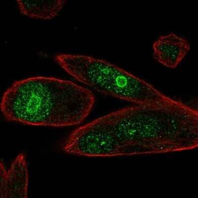 Immunocytochemistry/ Immunofluorescence: PHLDA1 Antibody [NBP2-56404]