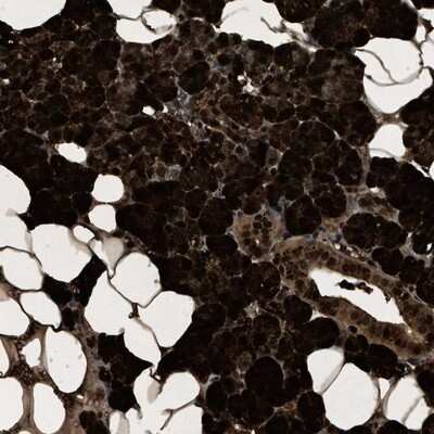 Immunohistochemistry-Paraffin: PHLDA1 Antibody [NBP1-84969]