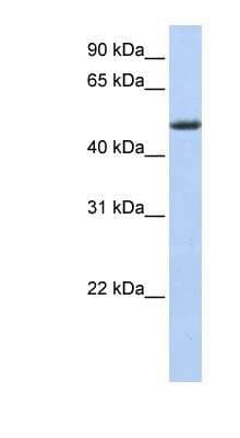 Western Blot: PHLDA1 Antibody [NBP1-53065]