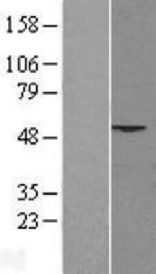 Western Blot: PHLDA1 Overexpression Lysate [NBL1-14367]