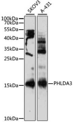 Western Blot: PHLDA3 AntibodyAzide and BSA Free [NBP2-93138]