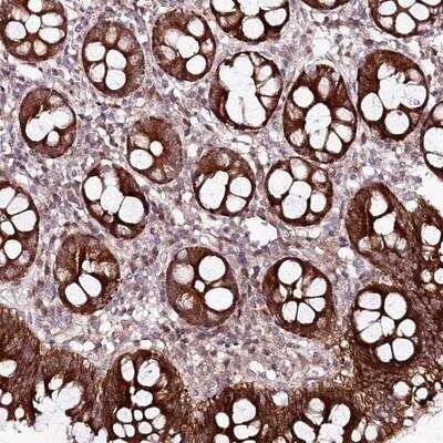 Immunohistochemistry-Paraffin: PHLDB1 Antibody [NBP1-90451]