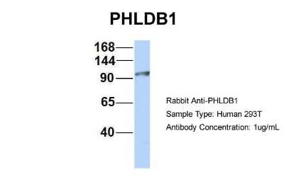 Western Blot: PHLDB1 Antibody [NBP2-88047]