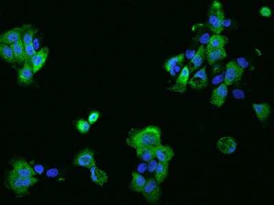 Immunocytochemistry/ Immunofluorescence: PHLDB2 Antibody [NBP2-97972]