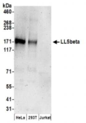 Western Blot: PHLDB2 Antibody [NBP2-36546]