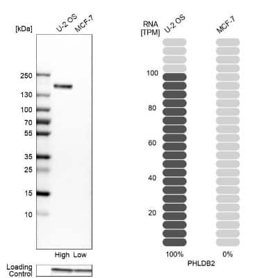 Western Blot: PHLDB2 Antibody [NBP2-38238]