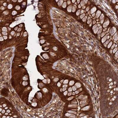 Immunohistochemistry-Paraffin: PHLDB3 Antibody [NBP1-93784]