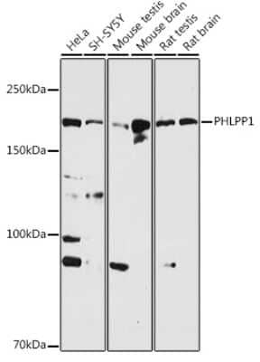 Western Blot: PHLPP AntibodyAzide and BSA Free [NBP2-93296]