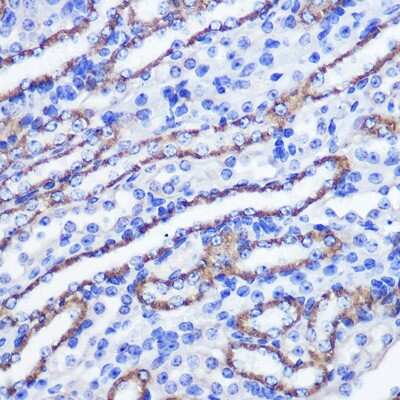 Immunohistochemistry-Paraffin: PHLPP Antibody - Azide and BSA Free [NBP2-93296]