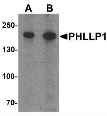 Western Blot: PHLPP AntibodyBSA Free [NBP2-81766]