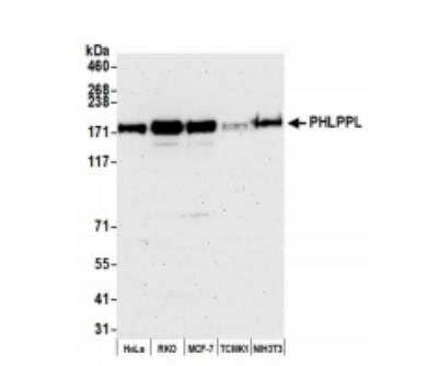 Western Blot: PHLPP2 Antibody [NB100-1812]