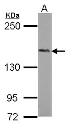 Western Blot: PHLPP2 Antibody [NBP2-19803]