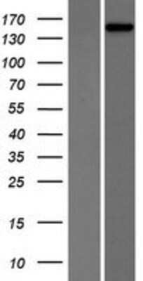 Western Blot: PHLPP2 Overexpression Lysate [NBP2-07231]