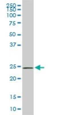 Western Blot: PHOSPHO1 Antibody (4B2) [H00162466-M04]