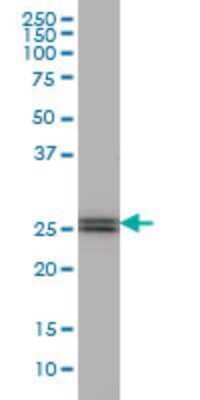 Western Blot: PHOSPHO1 Antibody (4B2) [H00162466-M04]