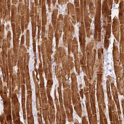 Immunohistochemistry: PHOSPHO1 Antibody [NBP2-49070]