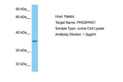 Western Blot: PHOSPHO1 Antibody [NBP1-98553]