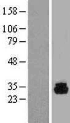 Western Blot: PHOSPHO1 Overexpression Lysate [NBP2-04955]