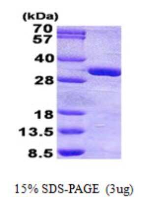 SDS-PAGE: Recombinant Human PHOSPHO1 His Protein [NBP2-23326]