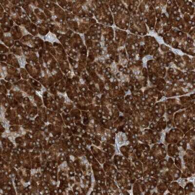 Immunohistochemistry: PHOSPHO2 Antibody [NBP2-38218]