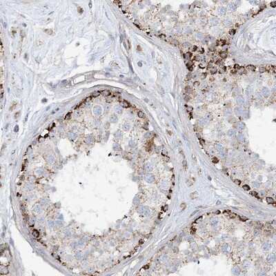 Immunohistochemistry-Paraffin: PHOSPHO2 Antibody [NBP1-81168]