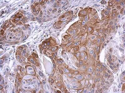 Immunohistochemistry-Paraffin: PHOSPHO2 Antibody [NBP2-19806]