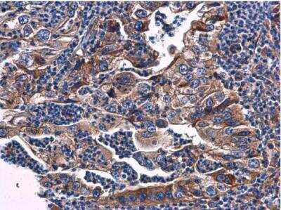 Immunohistochemistry-Paraffin: PHOSPHO2 Antibody [NBP2-19806]
