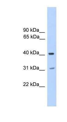 Western Blot: PHOSPHO2 Antibody [NBP1-80444]