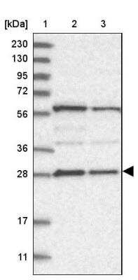 Western Blot: PHOSPHO2 Antibody [NBP1-81168]