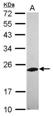 Western Blot: PHOSPHO2 Antibody [NBP2-19806]