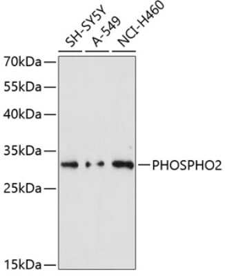 Western Blot: PHOSPHO2 AntibodyAzide and BSA Free [NBP2-93287]