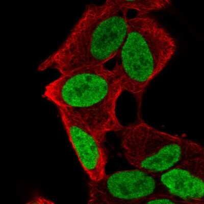 Immunocytochemistry/ Immunofluorescence: PHOX2A Antibody [NBP2-56644]