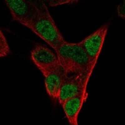 Immunocytochemistry/ Immunofluorescence: PHOX2A Antibody [NBP3-17910]