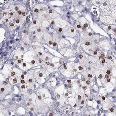 Immunohistochemistry-Paraffin: PHOX2A Antibody [NBP2-62721]