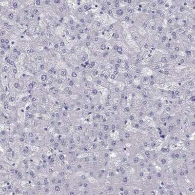 Immunohistochemistry-Paraffin: PHOX2A Antibody [NBP2-62721]