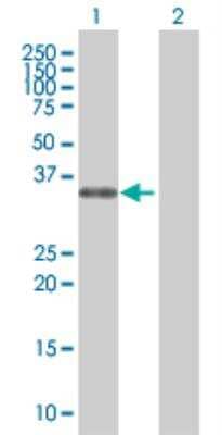 Western Blot: PHOX2A 293T Cell Transient Overexpression Lysate [H00000401-T01]