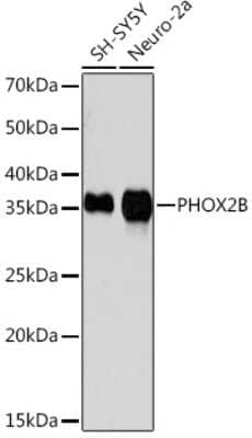 Western Blot: PHOX2B Antibody (4W5J8) [NBP3-16643]