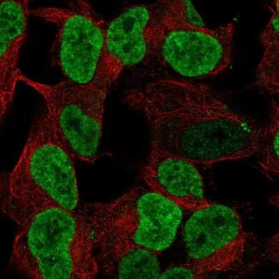 Immunocytochemistry/ Immunofluorescence: PHOX2B Antibody [NBP2-68991]