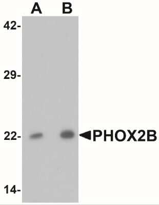 Western Blot: PHOX2B AntibodyBSA Free [NBP2-41179]