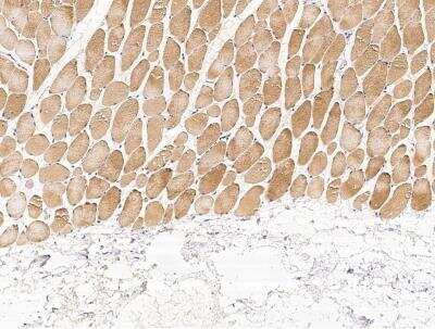 Immunohistochemistry-Paraffin: PHPT1 Antibody (001) [NBP2-90108]