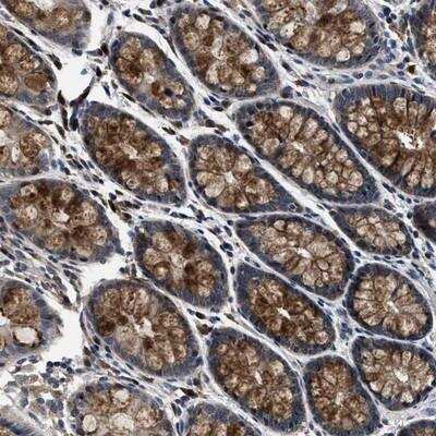 Immunohistochemistry-Paraffin: PHPT1 Antibody [NBP1-88804]