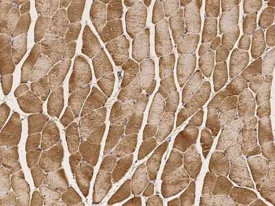 Immunohistochemistry-Paraffin: PHPT1 Antibody [NBP2-99999]