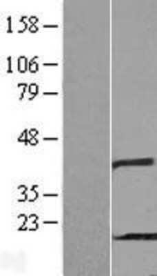 Western Blot: PHPT1 Overexpression Lysate [NBL1-14372]