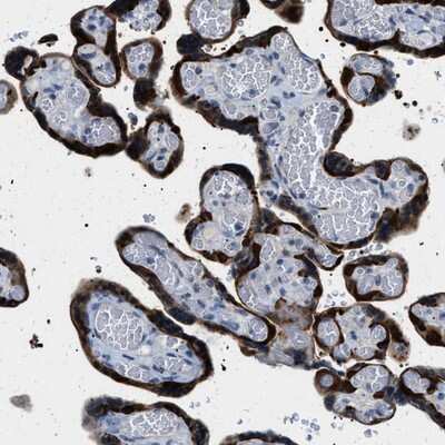 Immunohistochemistry-Paraffin: PHRF1 Antibody [NBP1-82903]