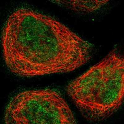 Immunocytochemistry/ Immunofluorescence: PHTF2 Antibody [NBP2-30990]